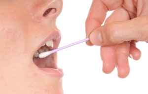 Buccal-Swabbing